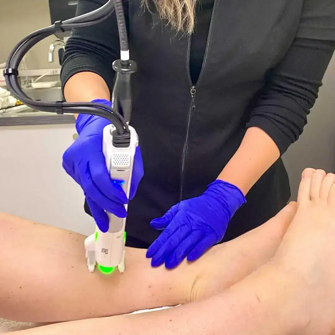 Laser hair removal at Glow Medispa West Seattle for smooth skin without shaving.